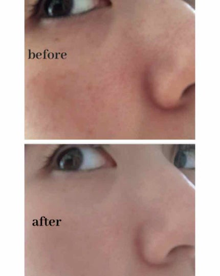 アルビオン タイトフィルム ファンデーション PRO/ALBION/リキッドファンデーションを使ったクチコミ(2枚目)