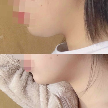 さな on LIPS 「こんにちは！比較画像は撮った間隔1日です。昨日の写真と、今日マ..」（1枚目）