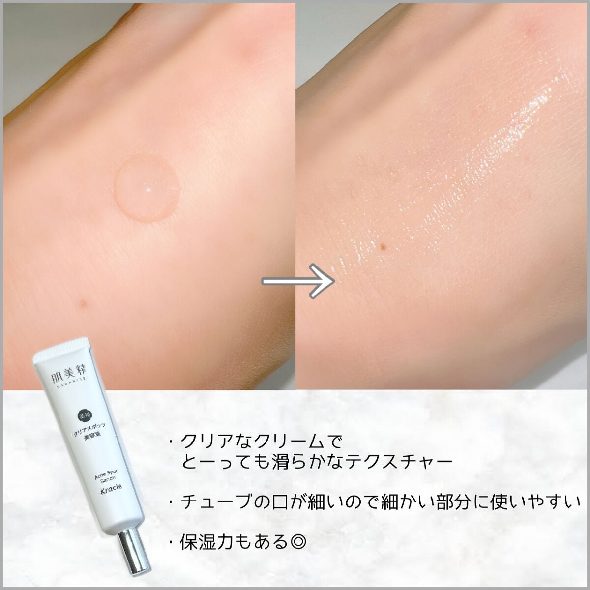 大人のニキビ対策 薬用クリアスポッツ美容液 /肌美精/美容液を使ったクチコミ(2枚目)