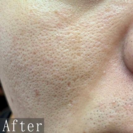 ダイブイン トナー/Torriden/化粧水を使ったクチコミ(6枚目)