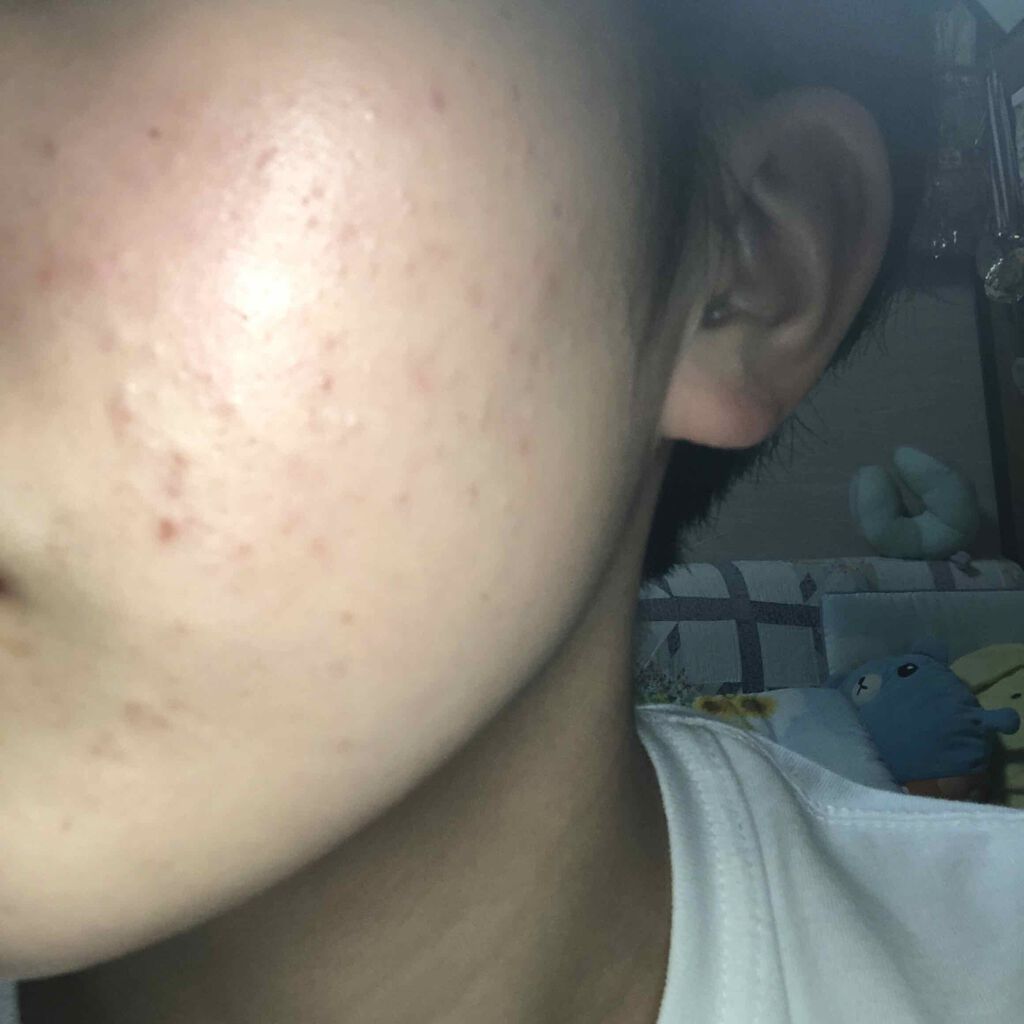 を使ったクチコミ（1枚目）