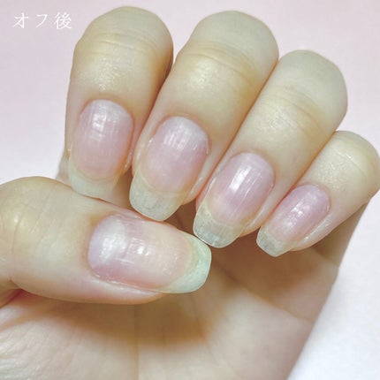 セミキュアジェルネイル(ハンド)/ohora/ネイルシールを使ったクチコミ(5枚目)