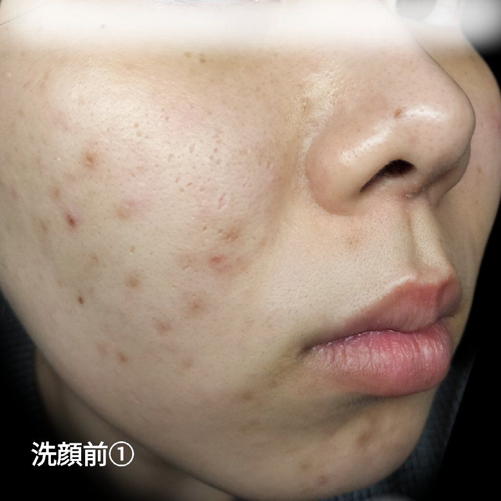 ディープクリア酵素洗顔	/メラノCC/洗顔フォームを使ったクチコミ（2枚目）