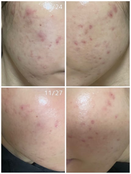 レチノール シカ リペア セラム/innisfree/美容液を使ったクチコミ(2枚目)