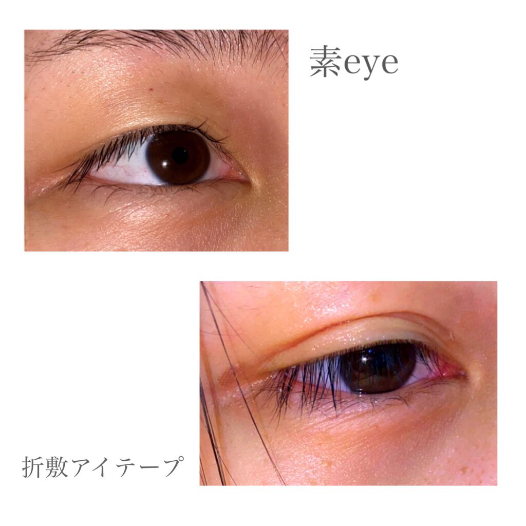 のびーるアイテープ（絆創膏タイプ、レギュラー）/DAISO/二重まぶた用アイテムを使ったクチコミ（3枚目）