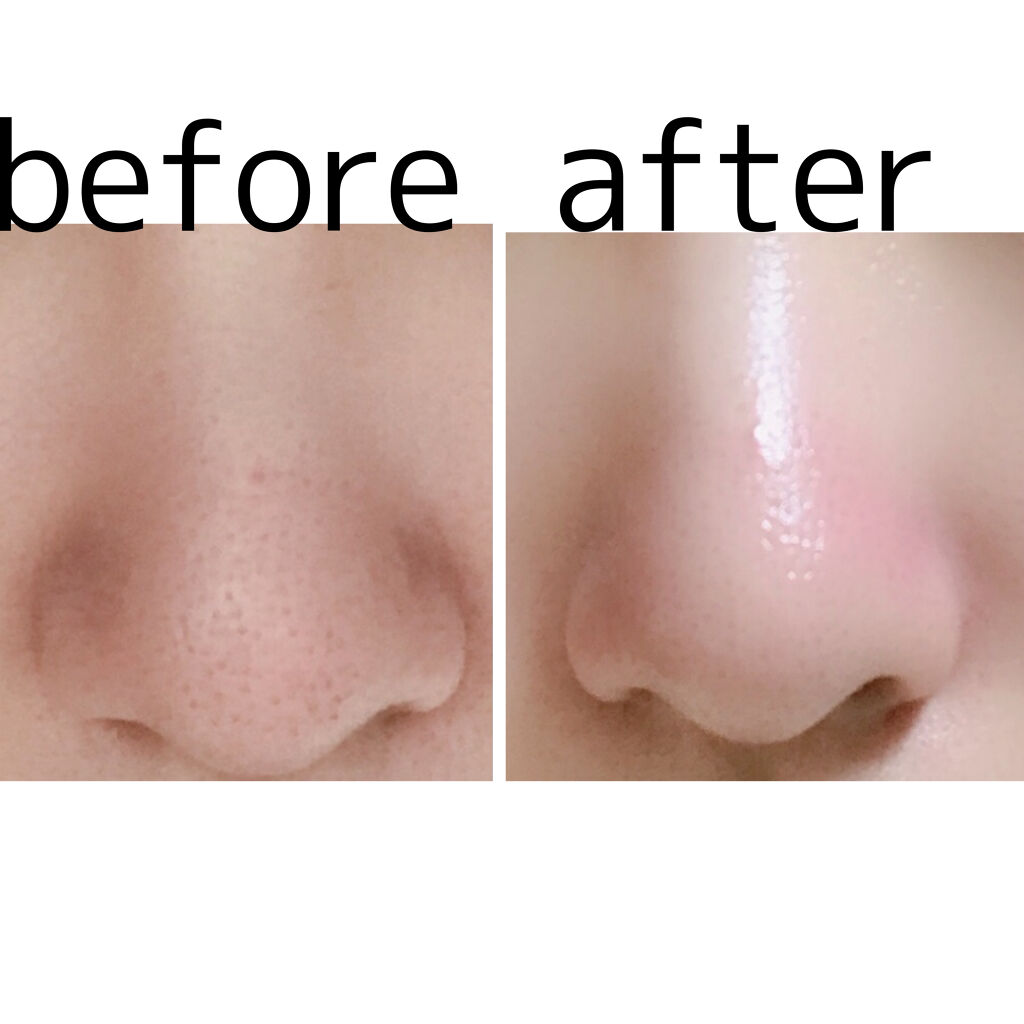 ハートリーフ ブラックヘッドクリーナー/BY ECOM/ピーリングを使ったクチコミ（2枚目）