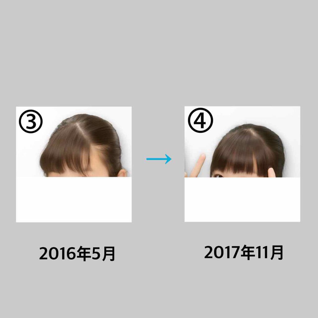 ミズ on LIPS 「初投稿失礼します!!今回は私の前髪事情についてお伝えしたいと思..」(3枚目)