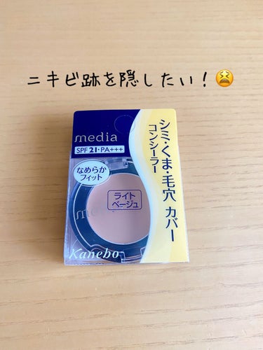 コンシーラーS/media/クリームコンシーラーを使ったクチコミ（1枚目）