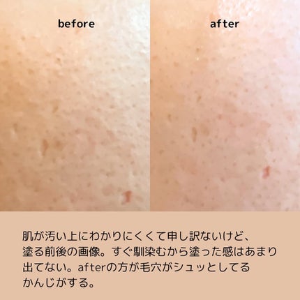 PDRNショット675/COSNORI/美容液を使ったクチコミ(5枚目)