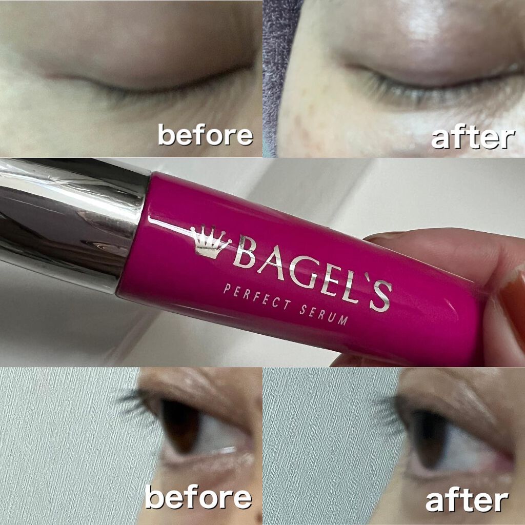 BAGEL S Perfect Serum/BAGEL/美容液を使ったクチコミ(2枚目)