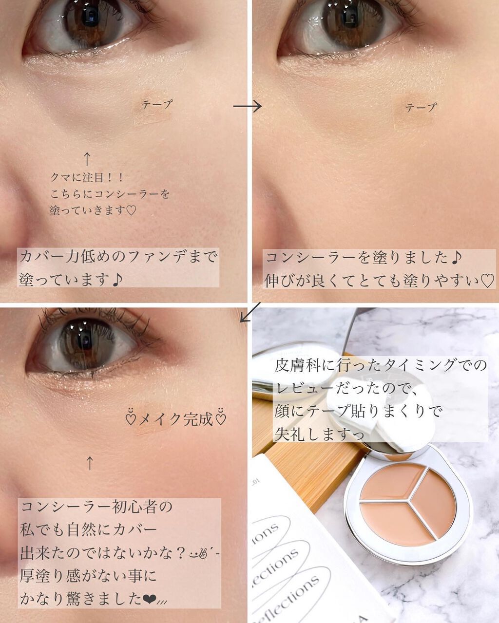 パーフェクトカバー コンシーラーパレット/Dear.A/パレットコンシーラーを使ったクチコミ(4枚目)