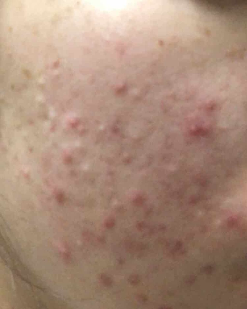 ウォッシャブル コールド クリーム/ちふれ/クレンジングクリームを使ったクチコミ(1枚目)