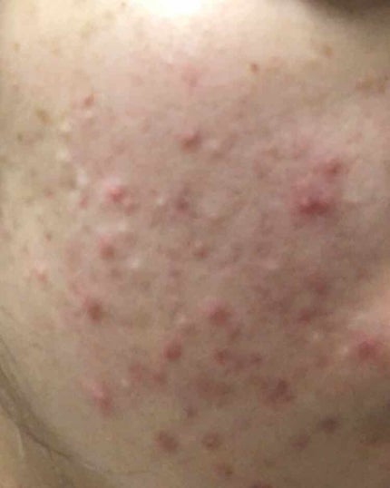 ウォッシャブル コールド クリーム/ちふれ/クレンジングクリームを使ったクチコミ(1枚目)