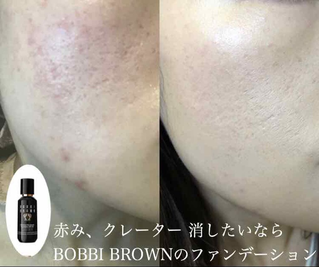 インテンシブ スキン セラム ファンデーション SPF40(PA++++)/BOBBI BROWN/リキッドファンデーションを使ったクチコミ(1枚目)