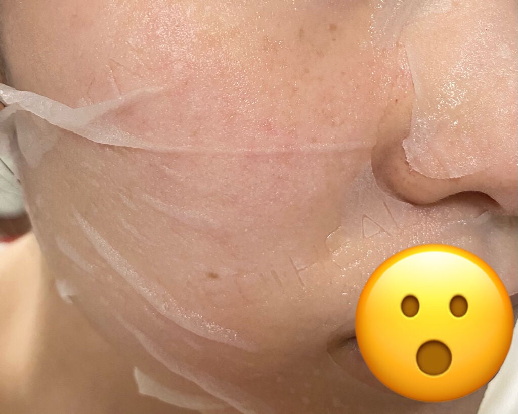 ビタライトビームエッセンシャルマスクEX/MEDIHEAL/シートマスク・パックを使ったクチコミ(2枚目)