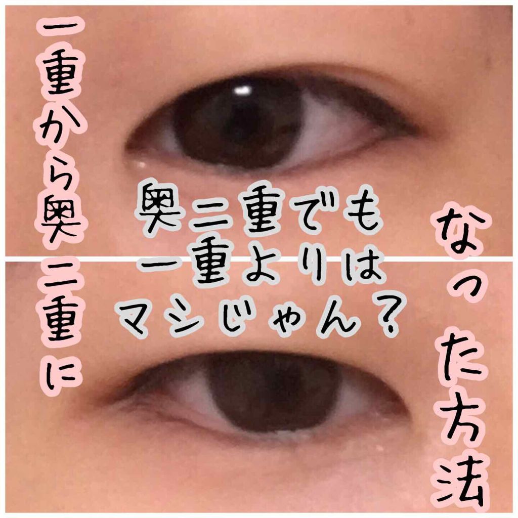 ワンダーアイリッドテープ Extra/D-UP/二重まぶた用アイテムを使ったクチコミ（1枚目）