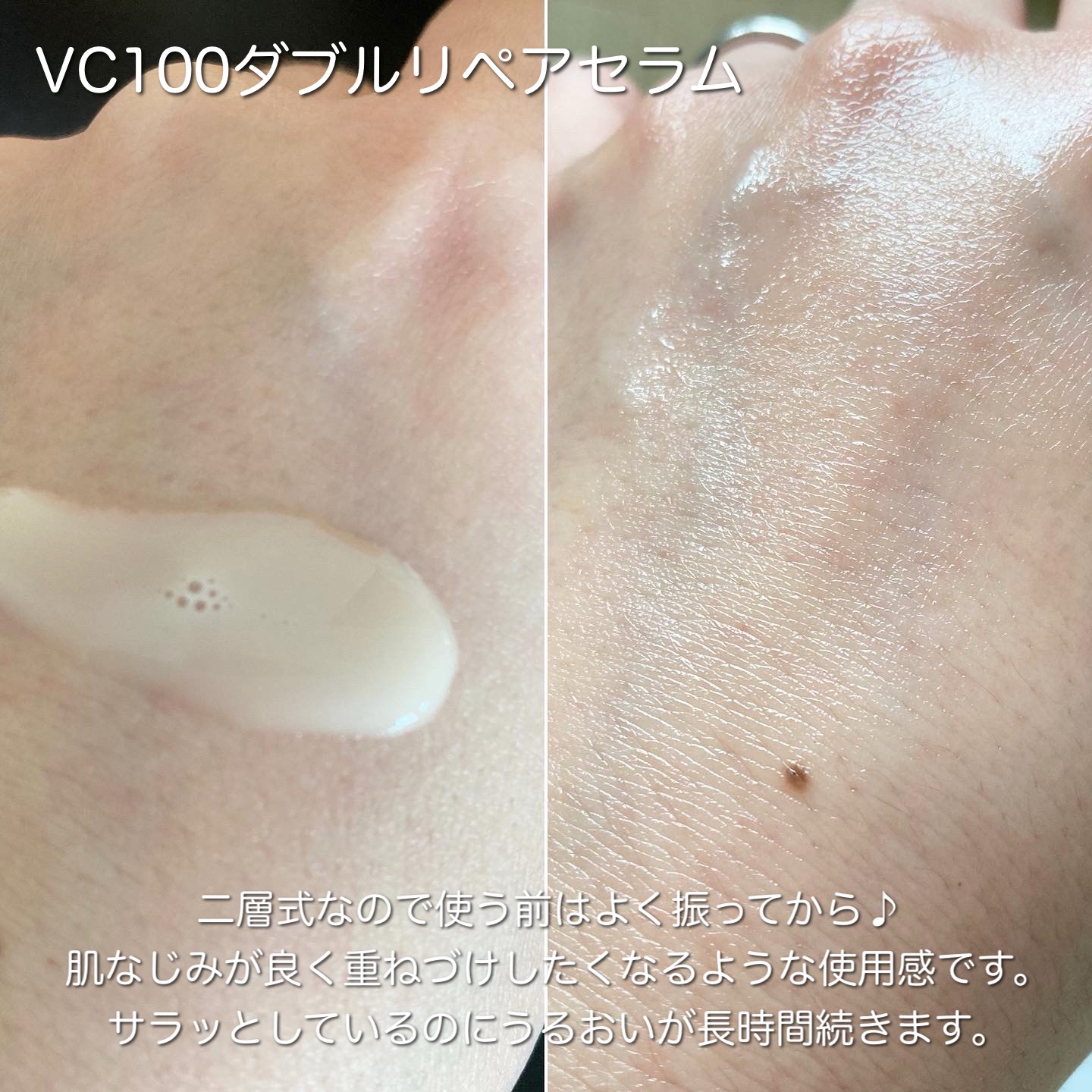 VC100ダブルリペアセラム/ドクターシーラボⓇ/美容液を使ったクチコミ（3枚目）