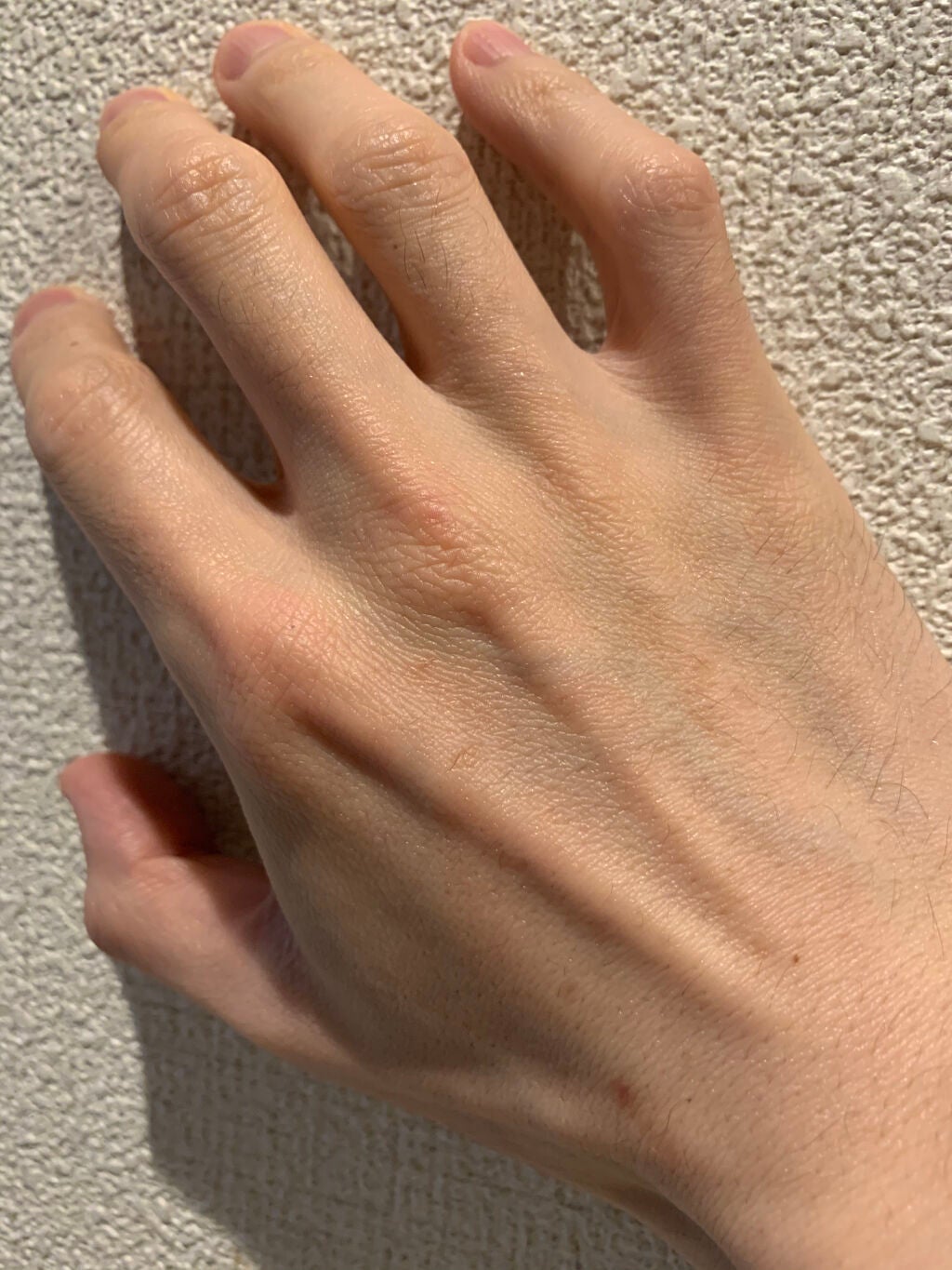 尿素10%クリーム/ハンド・尿素シリーズ/ハンドクリームを使ったクチコミ(3枚目)