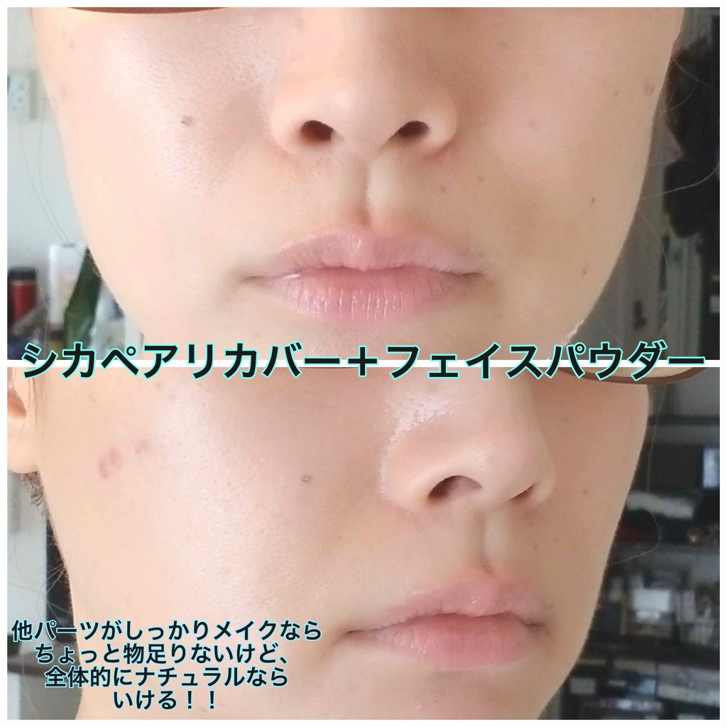 ドクタージャルト シカペア リカバー (第2世代)/Dr.Jart+/フェイスクリームを使ったクチコミ(3枚目)