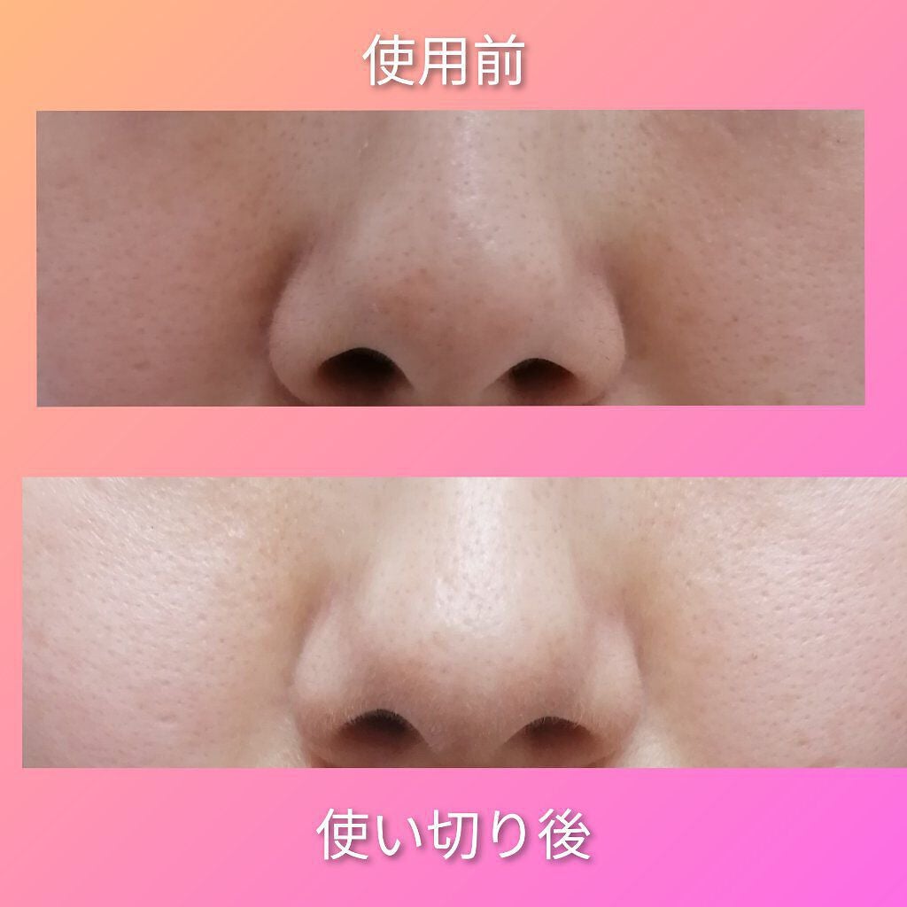 エマルジョンリムーバー 300ml/200ml/水橋保寿堂製薬/その他洗顔料を使ったクチコミ(2枚目)