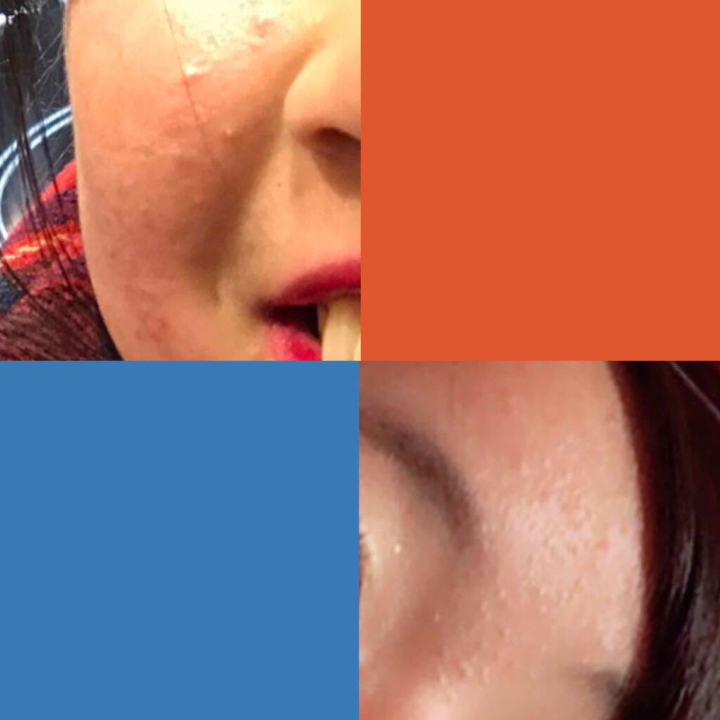 お米のマスク/毛穴撫子/シートマスク・パックを使ったクチコミ（2枚目）