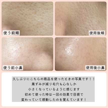 SHEE BY LITS 炭酸美容パック/リッツ/洗い流すパック・マスクを使ったクチコミ(5枚目)