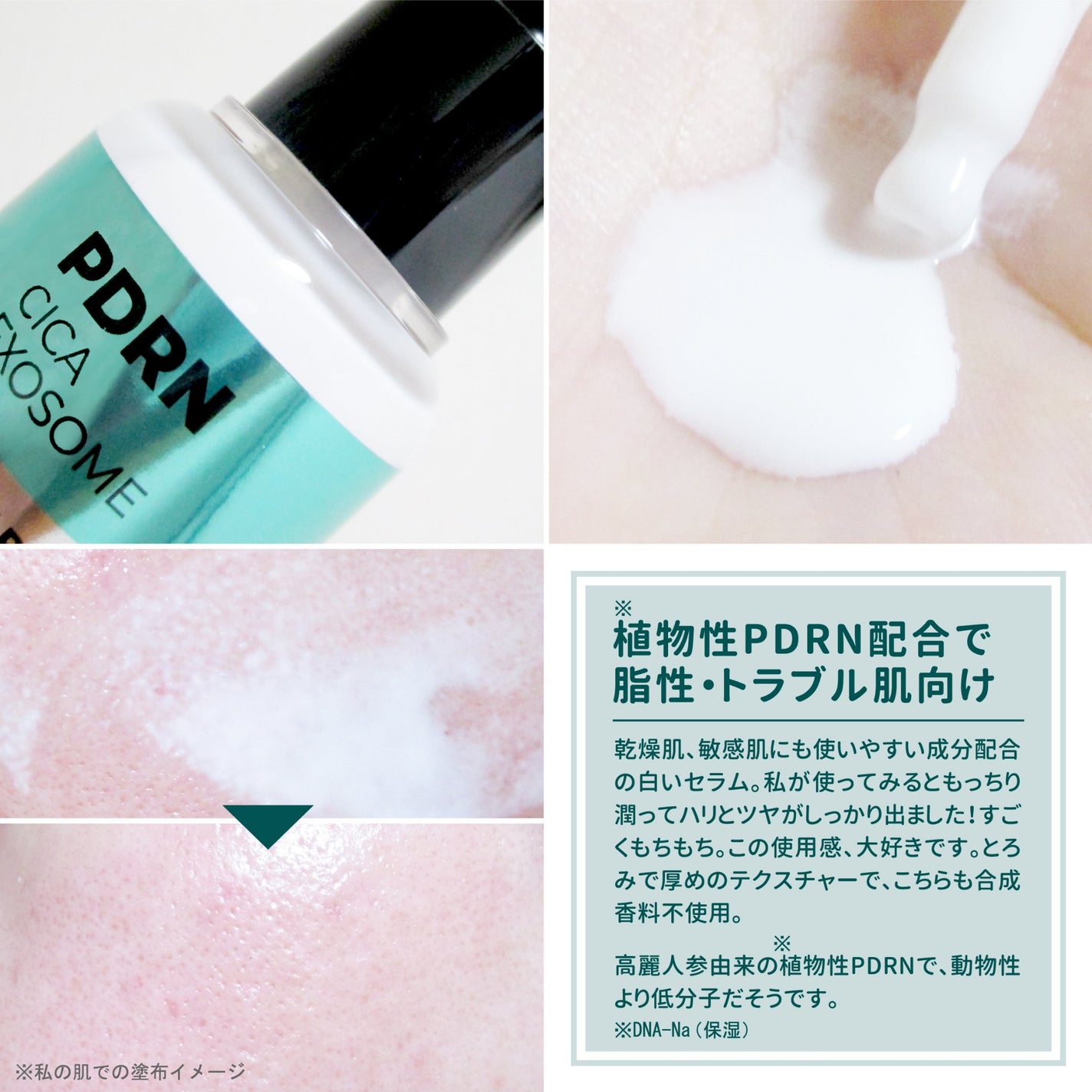 S100 ビタライトリードル/VT/美容液を使ったクチコミ(4枚目)