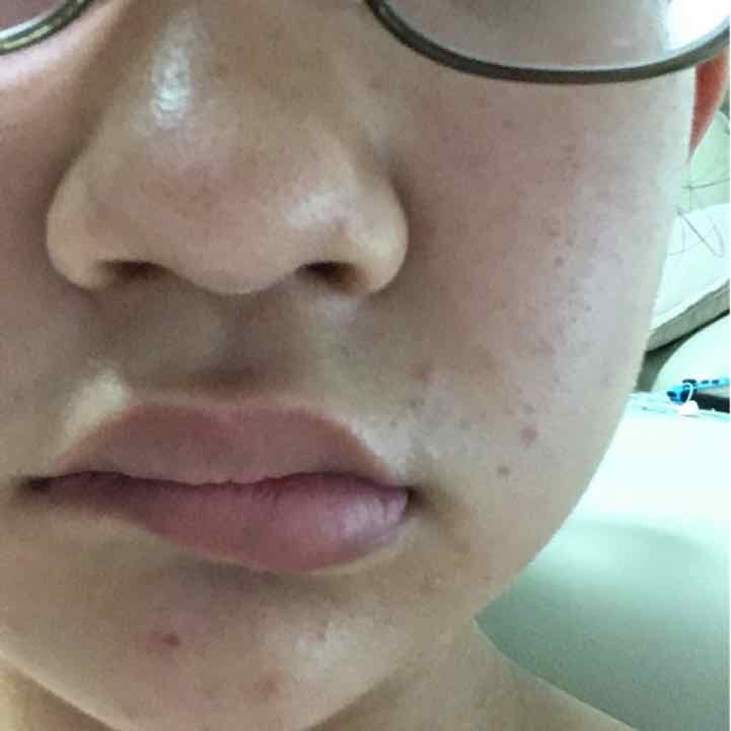 薬用パウダー化粧水/メンソレータム アクネス/化粧水を使ったクチコミ(2枚目)