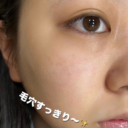 ツボクサ化粧水/ONE THING/化粧水を使ったクチコミ(7枚目)