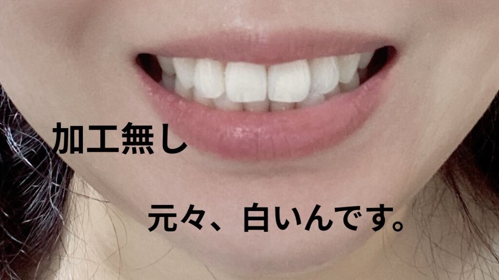 o-dent clear White/BITELA/歯磨き粉を使ったクチコミ（2枚目）