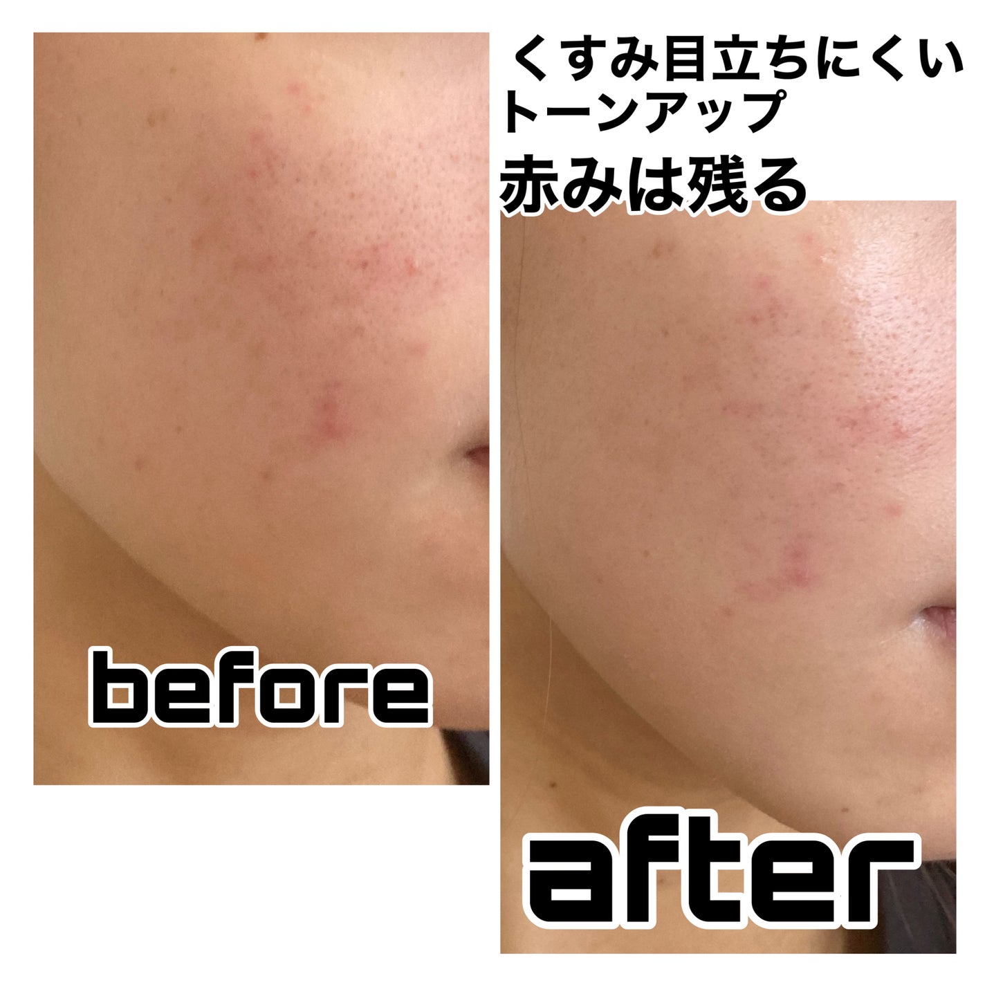 ãšãã¡ã¯ã© ããŒã«ã±ã¢ ã»ã©ã /ã© ããã·ã¥ ããŒ/çŸå®¹æ¶²ã䜿ã£ãã¯ãã³ãïŒ5æç®ïŒ