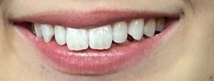 TEETH WHITENING STRIPS/3D WHITE/その他オーラルケアを使ったクチコミ(7枚目)