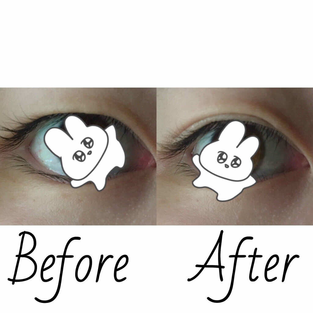 ハイブリッドフィルム/アイトーク/二重まぶた用アイテムを使ったクチコミ（2枚目）