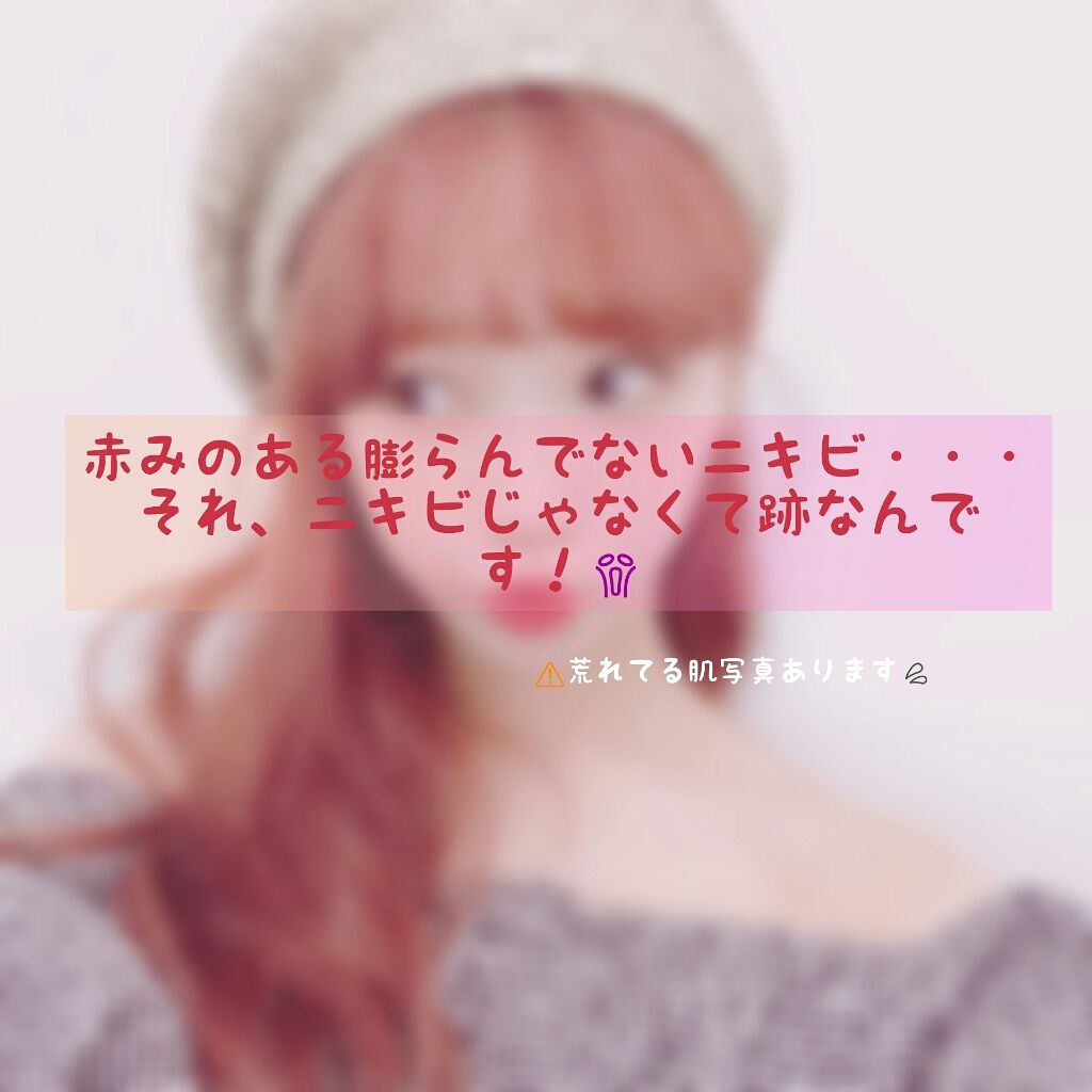 薬用洗顔フォーム/スキンライフ/洗顔フォームを使ったクチコミ（1枚目）