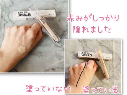 ダーマシンコンシーラー/23years old/リキッドコンシーラーを使ったクチコミ(2枚目)