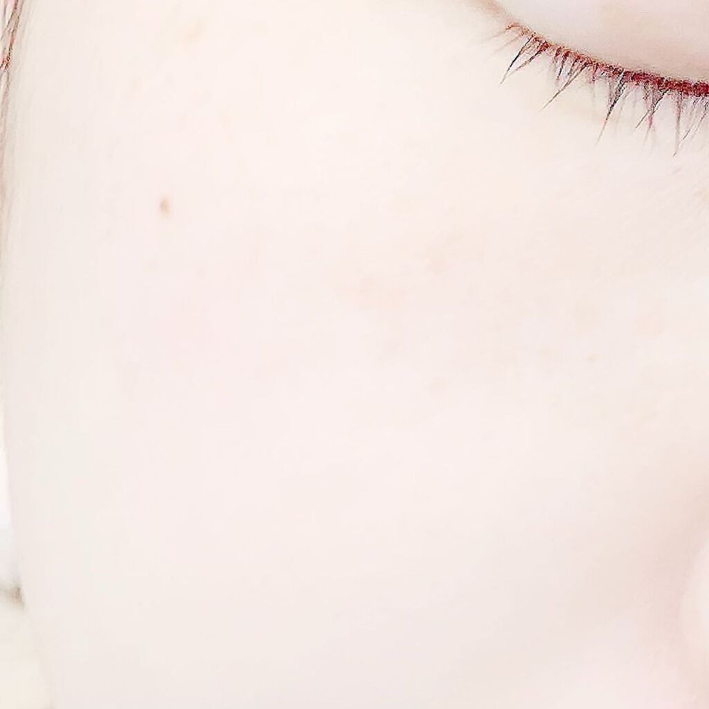 スパークリングパック/Urar /シートマスク・パックを使ったクチコミ(6枚目)