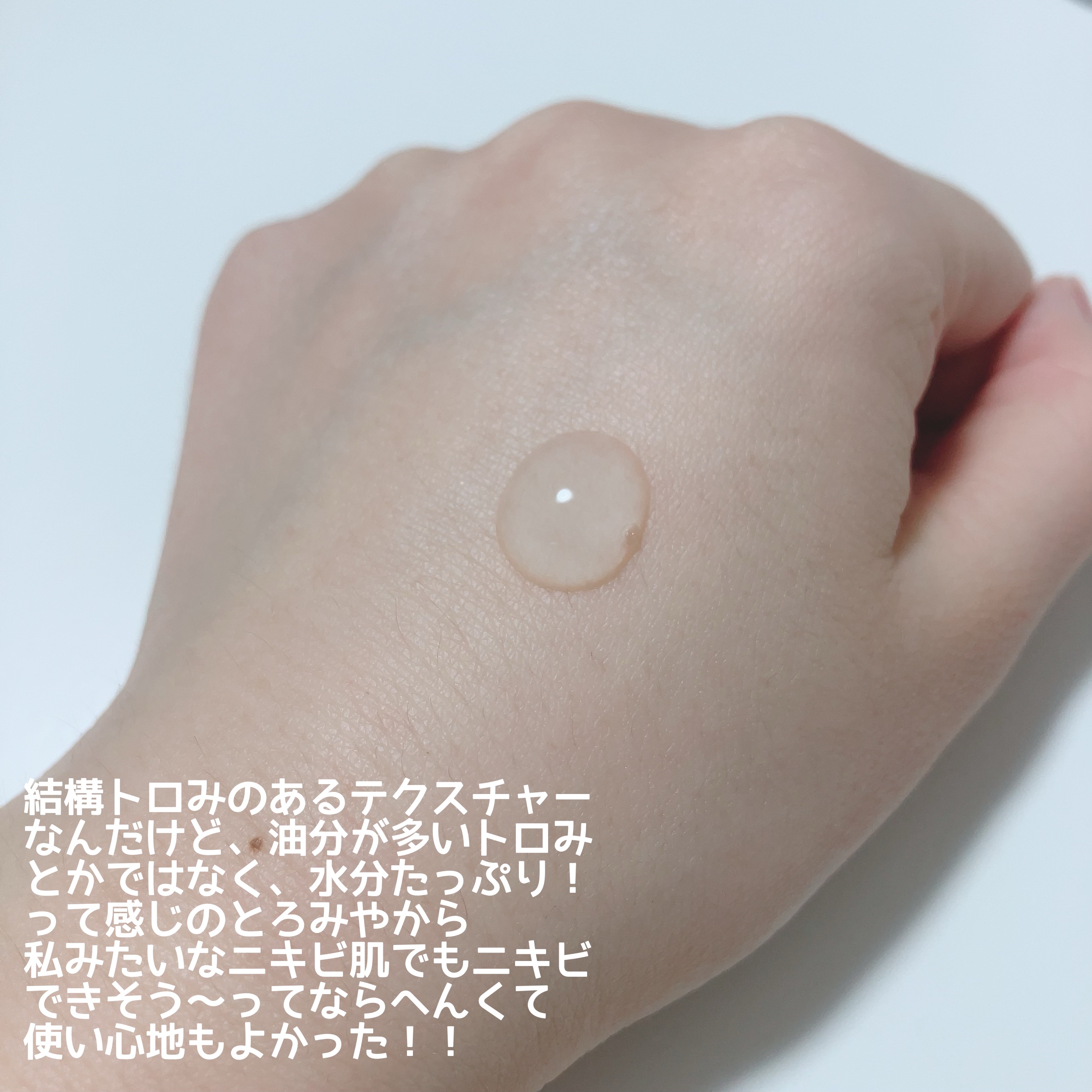 AAブレミッシュセラム/Shangpree/美容液を使ったクチコミ（2枚目）