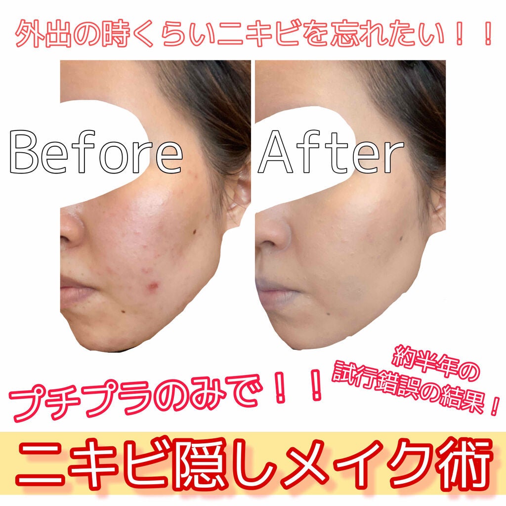 フェイスパウダー 薬用オークル/クリアラスト/プレストパウダーを使ったクチコミ(1枚目)