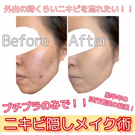 フェイスパウダー 薬用オークル/クリアラスト/プレストパウダーを使ったクチコミ(1枚目)