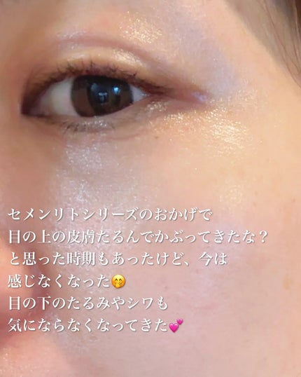 Cemenrete Calcium Intense Cream/Dr.Melaxin/フェイスクリームを使ったクチコミ(9枚目)