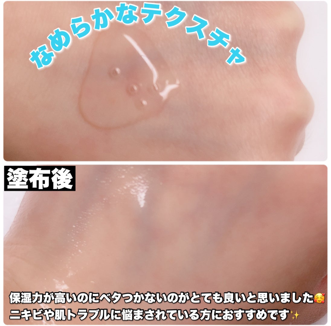 ピンクアロエムチンセラム/APRILSKIN/美容液を使ったクチコミ(3枚目)