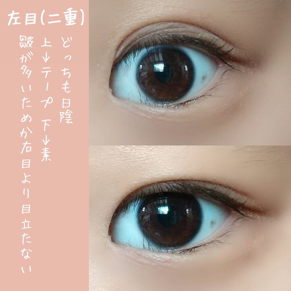 シングルアイテープ/Automatic Beauty/二重まぶた用アイテムを使ったクチコミ(5枚目)