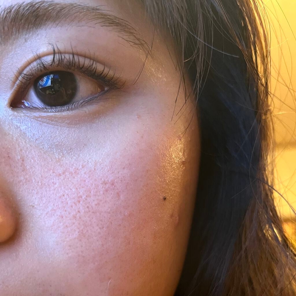 ティーツリーケア ソリューション エッセンシャルマスクEX/MEDIHEAL/シートマスク・パックを使ったクチコミ(3枚目)