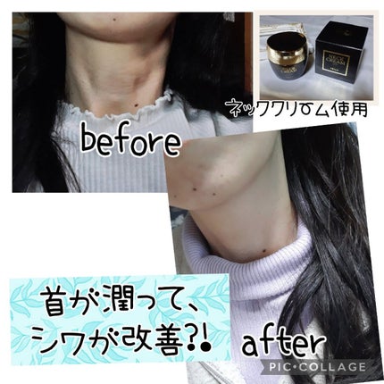 ベラ アルティメットエージ ネッククリーム/VELLA/フェイスクリームを使ったクチコミ(4枚目)