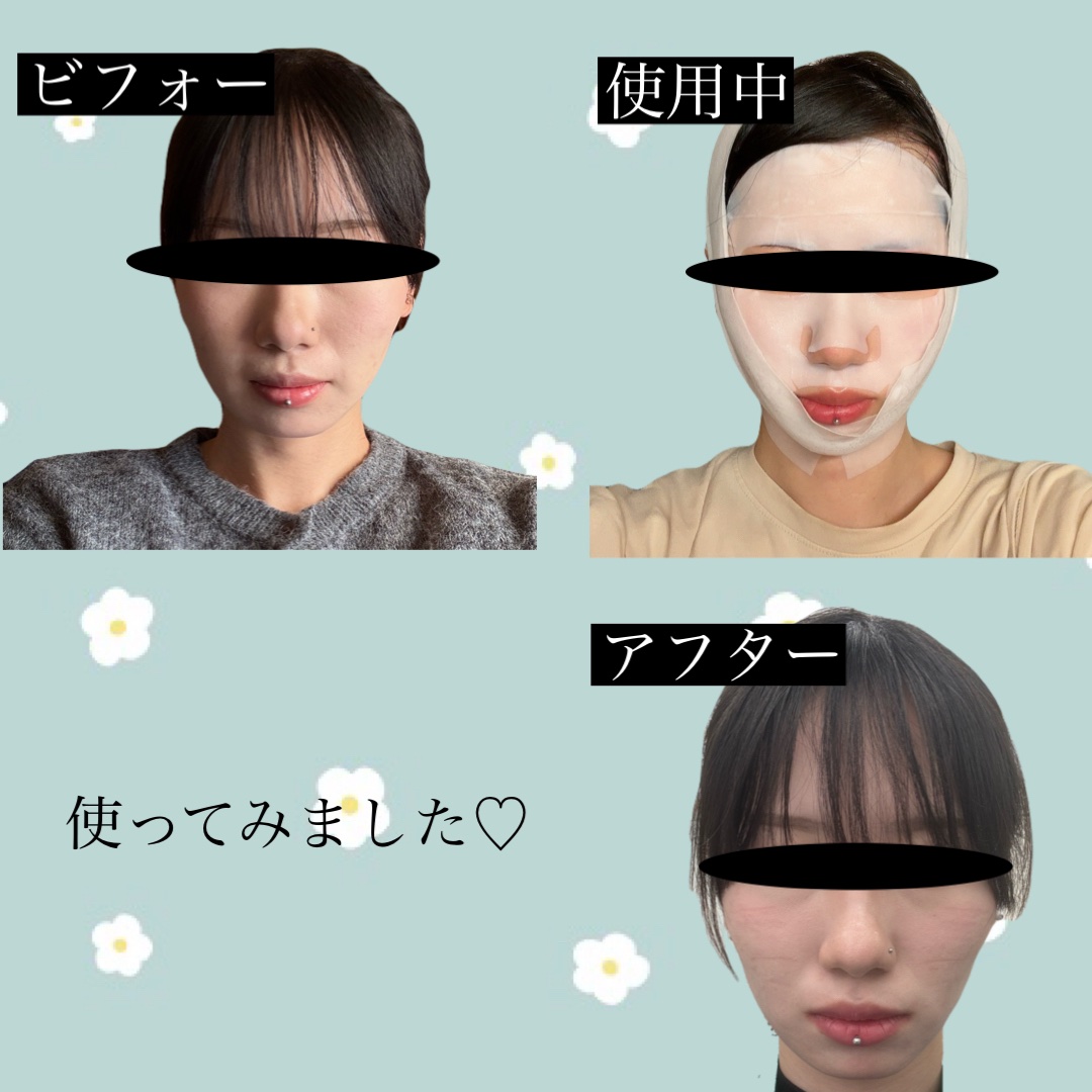 9番 NMNバイオリフトラッピングマスク/numbuzin/シートマスク・パックを使ったクチコミ（2枚目）