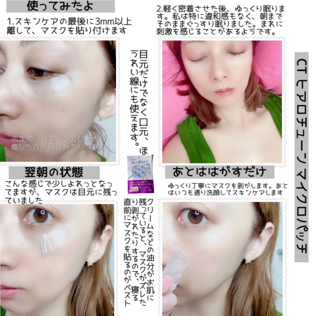 クリアターン ヒアロチューン マイクロパッチ 1500/クリアターン/シートマスク・パックを使ったクチコミ(5枚目)