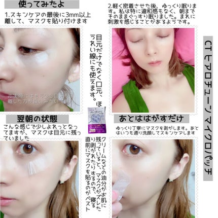 クリアターン ヒアロチューン マイクロパッチ 1500/クリアターン/シートマスク・パックを使ったクチコミ(5枚目)