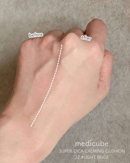 スーパーシカクッション/MEDICUBE/クッションファンデーションを使ったクチコミ(5枚目)