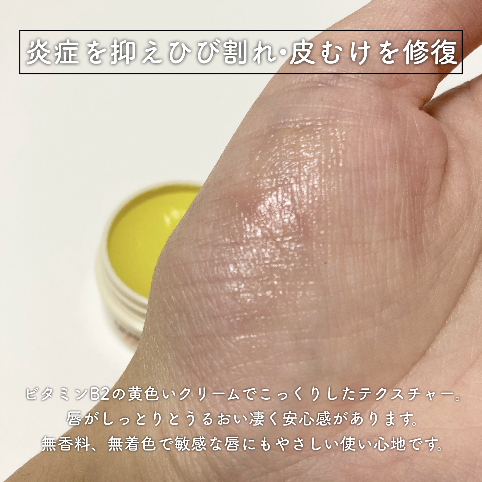 ユースキン メディカルリップクリーム 　(医薬品)/ユースキン/その他を使ったクチコミ（2枚目）