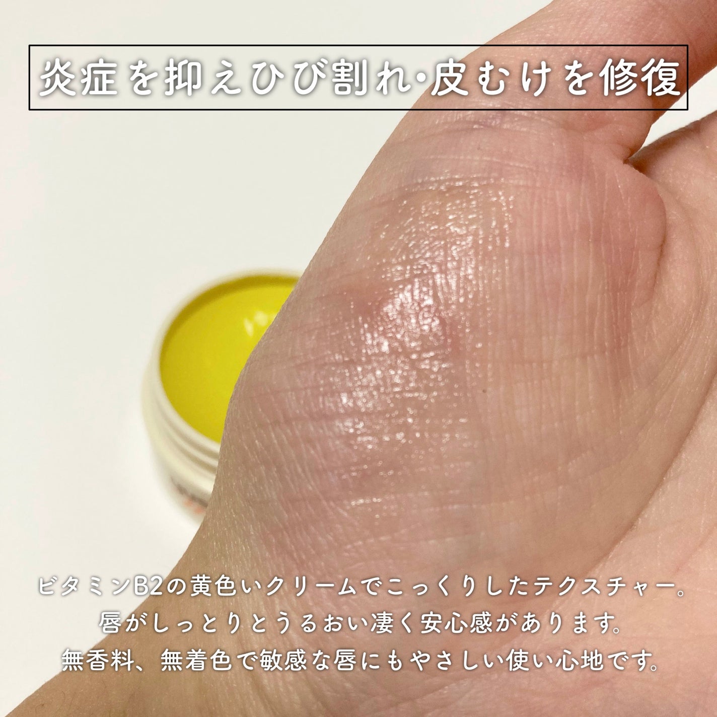 ユースキン メディカルリップクリーム (医薬品)/ユースキン/その他を使ったクチコミ(2枚目)